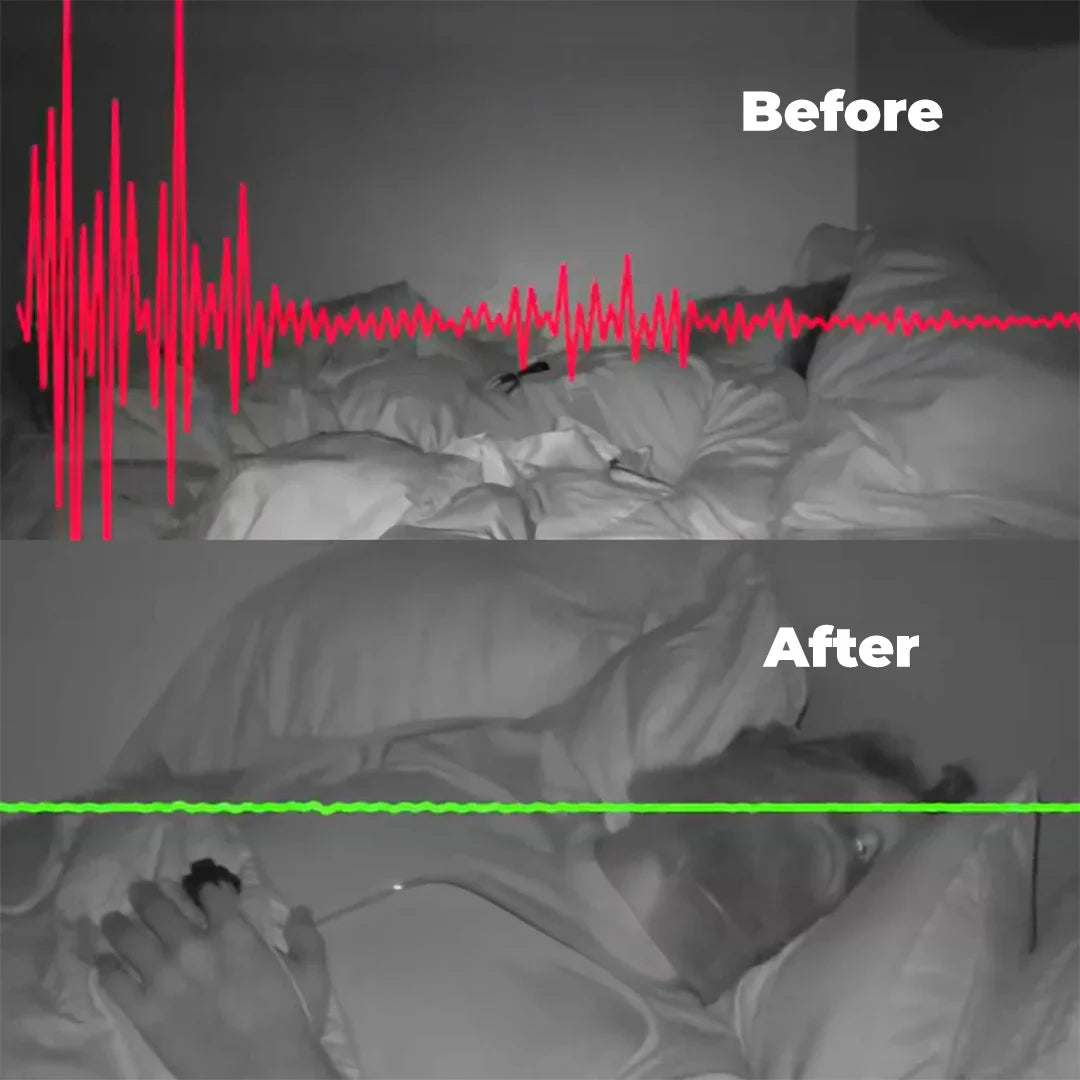 Anti-Snoring Mouthpiece